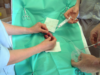 Embryo Transfer